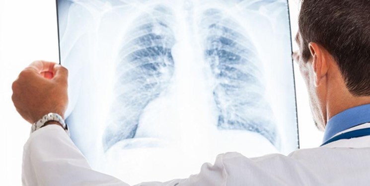 تفاوتهای «آنفلوانزا» و «کرونا» را بشناسید