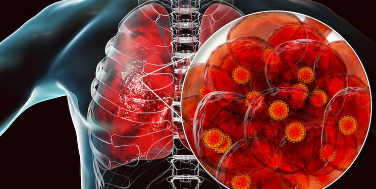 سیاست های اشتباه مشکل ویروس کرونا بر اقتصاد آمریکا را بیشتر کرده است